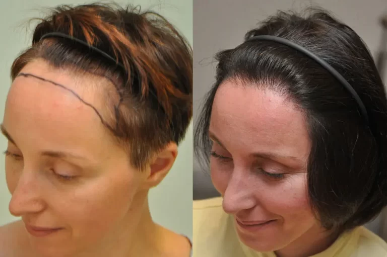 hajbeultetes noknek fue fut 02 01 768x511