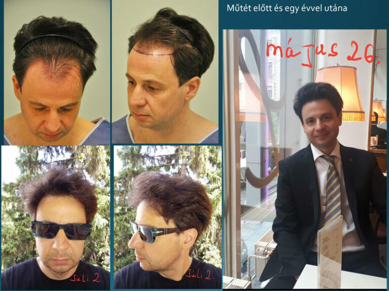 sikos hajbeultetes elotte utana 04 c 768x576